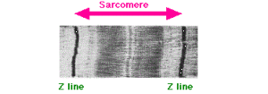Sarcomere